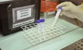 O Lacen tem em seu estoque o total de 5.100 testes pelo método de RT-PCR, sendo 1.100 recebidos pelo Ministério da Saúde e outros 4.000 recebidos por meio de doação feita pela Petrobrás