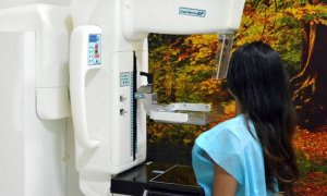 No Tocantins, no ano de 2014, foram realizadas 28.937 mamografias